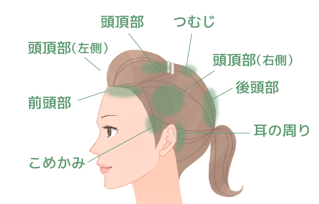 30代 40代で白髪が増えるのはなぜ 原因や対策方法を解説 エルゴン公式ショップ