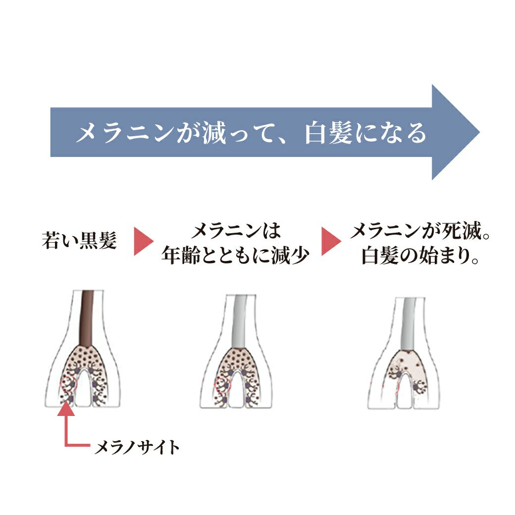 エルゴン　ＧＨアンチグレイシャンプー＆ローション セット eLGON